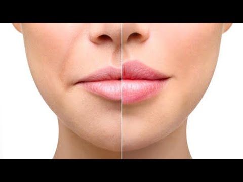 dudak büyütme - Evde Doğal Yöntemlerle Dudak Büyütme: Kalıcı Dudak Dolgunlaştırma İçin İpuçları