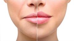 Evde Doğal Yöntemlerle Dudak Büyütme: Kalıcı Dudak Dolgunlaştırma İçin İpuçları