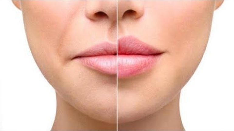 Evde Doğal Yöntemlerle Dudak Büyütme: Kalıcı Dudak Dolgunlaştırma İçin İpuçları